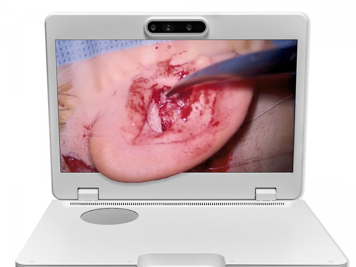 达擎之＂Heads-up 3D显微手术显示系统＂，整合4K裸眼3D显示及眼球追踪系统，具备快速追踪人眼移动位置功能，减轻医师长时间维持固定姿势的负担，让医师能有更宽广清晰的3D立体视野及更舒适的姿势来执行手术。